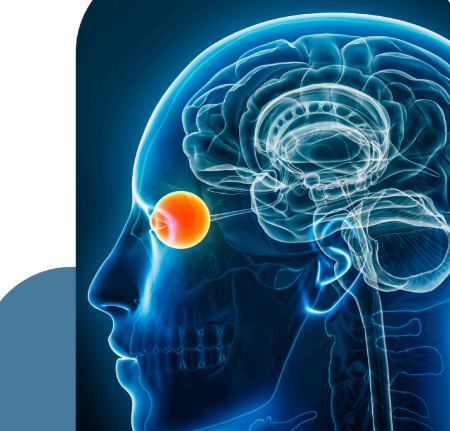 La Cerebral Visual Impairment (CVI) dalla diagnosi alla terapia: la necessità di un approccio multidisciplinare