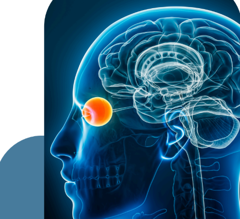 La Cerebral Visual Impairment (CVI) dalla diagnosi alla terapia: la necessità di un approccio multidisciplinare